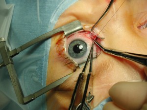 Doctor of Optometry (OD) Pakistan