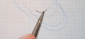 Staples or Sutures: Which Is Better After C-Section?