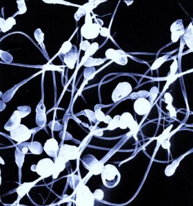A scanning electron micrograph of mature sperm.