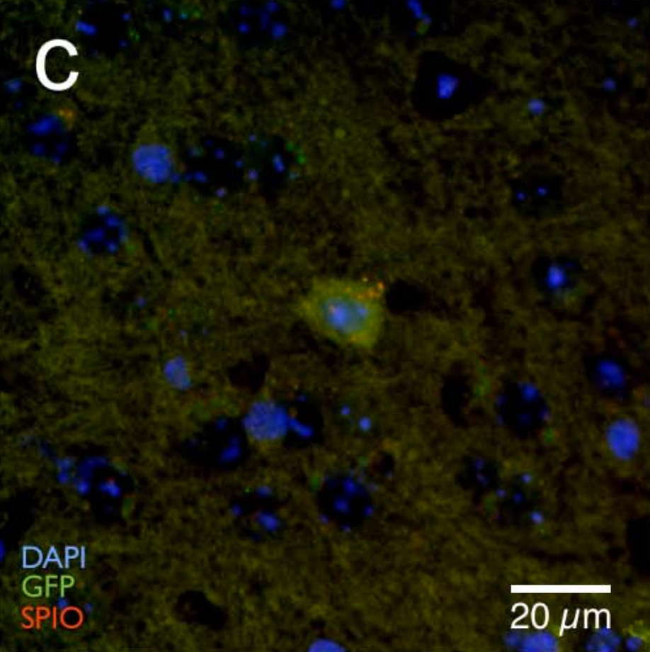 Individual cells in a mouse brain, labelled with SPIO and imaged by MRI