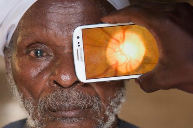 New Device Performs Eye Exams With Smartphone 1 New Device Performs Eye Exams With Smartphone