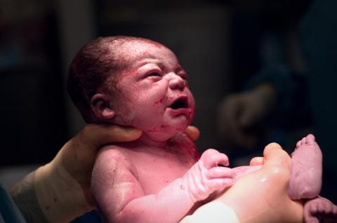 In a rare case, a clinically dead woman in Italy gave birth to a healthy child.