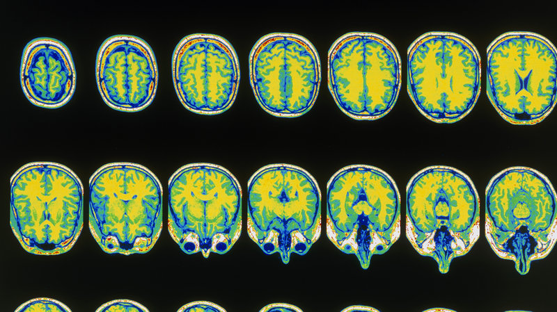 What If Sharing Your MRI Was As Simple As Pinterest? 1 What If Sharing Your MRI Was As Simple As Pinterest?