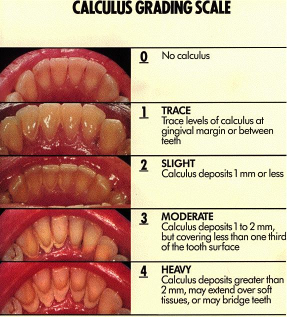 denta calculus grading scale