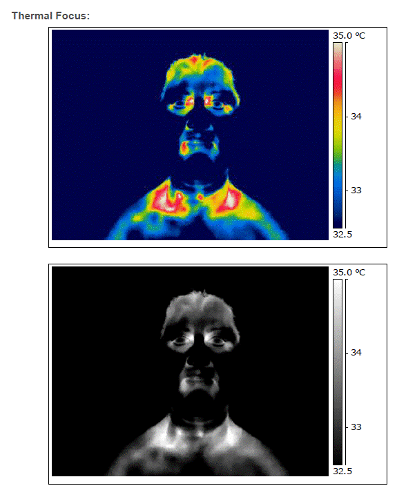 thermography-1