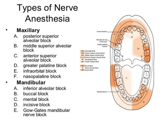 Local Anesthesia Injection Sites