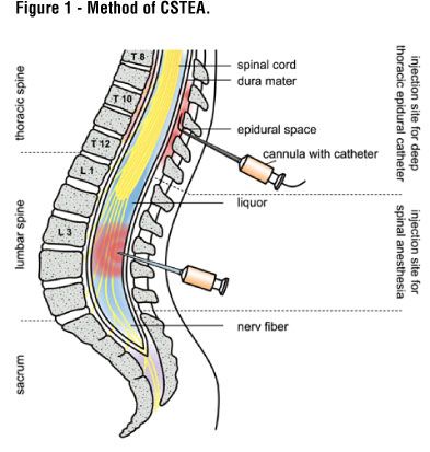 anesthesia cst