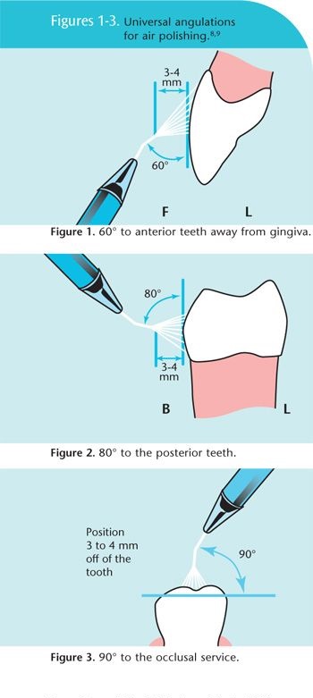 polishing angles