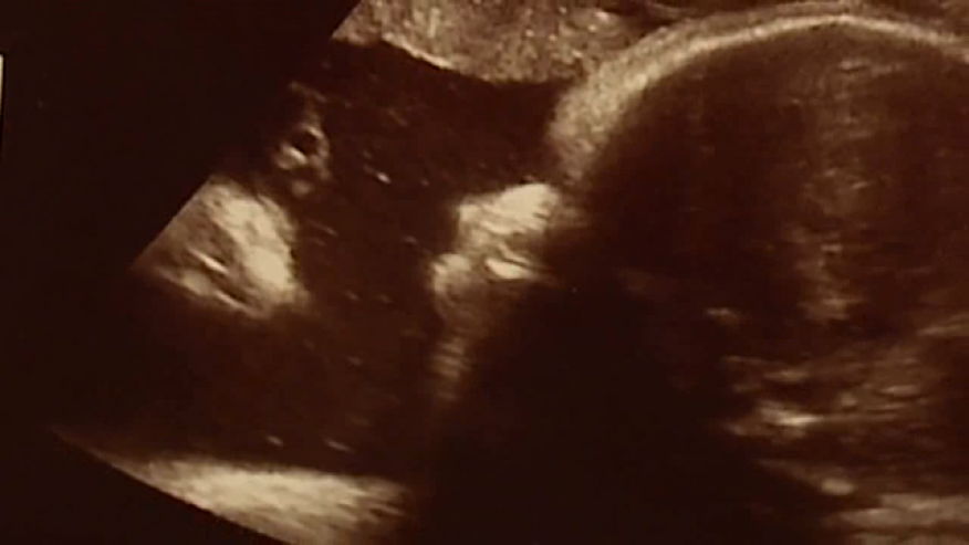Pennsylvania couple sees 'Jesus' in sonogram of baby daughter